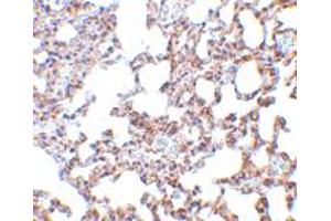 Immunohistochemistry of SKIL in mouse lung tissue with SKIL polyclonal antibody  at 5 ug/mL . (SKIL 抗体  (N-Term))