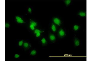 Immunofluorescence of monoclonal antibody to SMAD1 on HeLa cell. (SMAD1 抗体  (AA 1-465))
