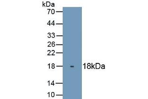 Detection of Recombinant TP63, Human using Monoclonal Antibody to Tumor Protein P63 (TP63) (p63 抗体  (AA 540-680))