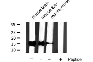 Western blot analysis of extracts of various samples,using Cytochrome c Antibody. (Cytochrome C 抗体)