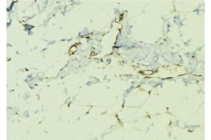 ABIN6276411 at 1/100 staining Human lung tissue by IHC-P. (ILK 抗体  (C-Term))