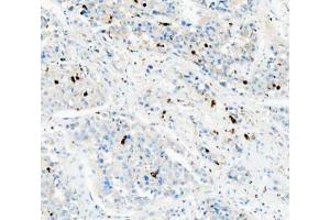 IHC analysis of CD68 using anti-CD68 antibody (ABIN7600142).