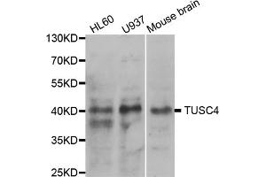 Western blot analysis of extracts of various cell lines, using NPRL2 antibody.