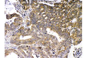 Immunohistochemistry (IHC) image for anti-Glutamate Decarboxylase 2 (Pancreatic Islets and Brain, 65kDa) (GAD2) (AA 131-164), (N-Term) antibody (ABIN5518755)
