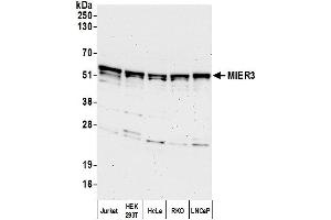 Western Blotting (WB) image for anti-Mesoderm Induction Early Response 1, Family Member 3 (MIER3) (AA 400-450) antibody (ABIN7449769)