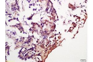 Immunohistochemistry (Paraffin-embedded Sections) (IHC (p)) image for anti-Eukaryotic Translation Initiation Factor 4E Binding Protein 1 (EIF4EBP1) (pSer65), (pThr70) antibody (ABIN703150)