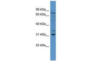 Image no. 1 for anti-F-Box Protein 34 (FBXO34) (AA 71-120) antibody (ABIN6746487) (FBXO34 抗体  (AA 71-120))
