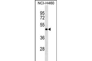 SG Antibody (N-term) (ABIN1539497 and ABIN2849755) western blot analysis in NCI- cell line lysates (35 μg/lane). (SGPP2 抗体  (N-Term))