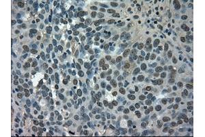 Immunohistochemistry (IHC) image for anti-Solute Carrier Family 2 (Facilitated Glucose/fructose Transporter), Member 5 (SLC2A5) antibody (ABIN2721986)