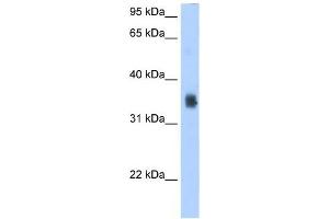 SLC35F2 antibody used at 2. (SLC35F2 抗体  (N-Term))
