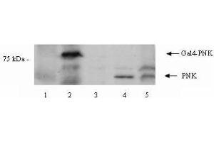 Image no. 1 for anti-Polynucleotide Kinase 3'-Phosphatase (PNKP) (Internal Region) antibody (ABIN401253) (PNKP 抗体  (Internal Region))