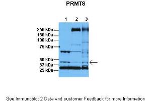 Lanes:   1: 30ug HeLa lysate, 2: 30ug HFF lysate, 3: 30ug U2OS lysate  Primary Antibody Dilution:   1:1000  Secondary Antibody:   Anti-rabbit HRP  Secondary Antibody Dilution:   1:5000  Gene Name:   PRMT8  Submitted by:   Dr. (PRMT8 抗体  (C-Term))