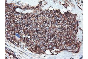 Immunohistochemistry (IHC) image for anti-Cytochrome P450, Family 2, Subfamily B, Polypeptide 6 (CYP2B6) antibody (ABIN2718982)