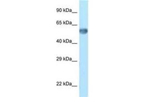 Image no. 1 for anti-Zinc Finger Protein 394 (ZNF394) (C-Term) antibody (ABIN6748078) (ZNF394 抗体  (C-Term))