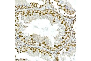 Immunohistochemistry of paraffin-embedded mouse testis using T Rabbit mAb (ABIN7270715) at dilution of 1:25 (40x lens).