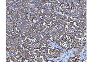 IHC analysis of Tryptophan Hydroxylase/TPH1 using anti-Tryptophan Hydroxylase/TPH1 antibody (ABIN7601556).