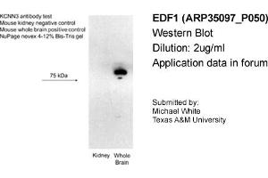 Western Blotting (WB) image for anti-Small Conductance Calcium-Activated Potassium Channel Protein 3 (KCNN3) (C-Term) antibody (ABIN2776146) (KCNN3 抗体  (C-Term))