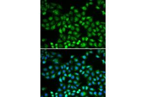 Immunofluorescence (IF) image for anti-Proteasome (Prosome, Macropain) Subunit, beta Type, 1 (PSMB1) (AA 29-241) antibody (ABIN6146309)