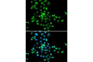 Immunofluorescence analysis of MCF-7 cells using SBDS antibody (ABIN5973483). (SBDS 抗体)
