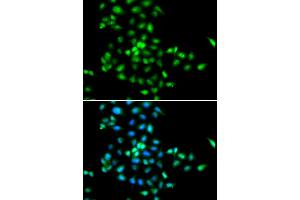 Immunofluorescence analysis of MCF-7 cells using SBDS antibody (ABIN5973483). (SBDS 抗体)