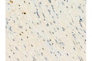Phospho-MeCP2 (Ser423) Antibody at 1/100 staining Mouse heart tissue by IHC-P. (MECP2 抗体  (pSer423))
