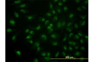 Immunofluorescence of monoclonal antibody to CDC14A on HeLa cell. (CDC14A 抗体  (AA 431-530))