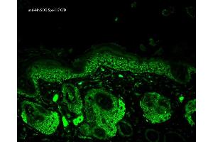 Immunohistochemistry analysis using Rabbit Anti-SOD2 Polyclonal Antibody . (SOD2 抗体  (PerCP))