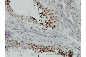 Immunoperoxidase of monoclonal antibody to HMGB2 on formalin-fixed paraffin-embedded human testis. (HMGB2 抗体  (AA 1-195))