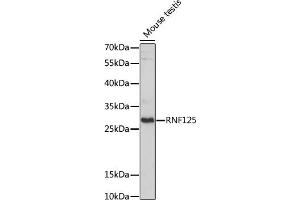 Western blot analysis of extracts of Mouse testis, using RNF125 antibody (ABIN7270057) at 1:1000 dilution. (RNF125 抗体  (AA 1-105))