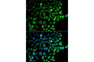 Immunofluorescence analysis of  cells using R antibody (ABIN6128595, ABIN6146569, ABIN6146571 and ABIN6220321). (RAB31 抗体  (AA 1-195))