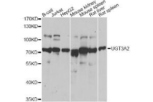 Western blot analysis of extracts of various cell lines, using UGT3A2 antibody.