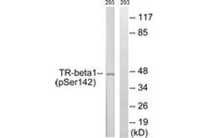 Western blot analysis of extracts from 293 cells treated with PMA 125ng/ml 30', using TR-beta1 (Phospho-Ser142) Antibody. (THRB 抗体  (pSer142))