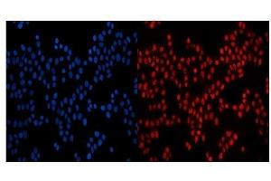 IF analysis of GP210/NUP210 using anti-GP210/NUP210 antibody (ABIN7600707). (NUP210 抗体  (AA 221-1724))