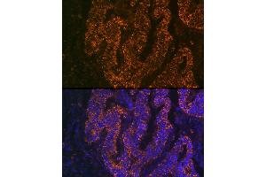 Immunofluorescence (IF) image for anti-Carcinoembryonic Antigen-Related Cell Adhesion Molecule 6 (CEACAM6) antibody (ABIN7266085)