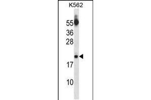 Western blot analysis in K562 cell line lysates (35ug/lane). (SAP18 抗体  (AA 58-86))