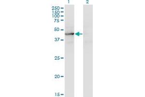 Western Blot analysis of TEX28 expression in transfected 293T cell line by TEX28 monoclonal antibody (M05), clone 1A8. (TEX28 抗体  (AA 1-410))