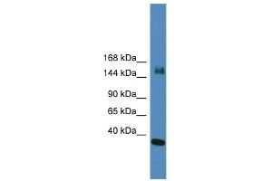 WB Suggested Anti-UTX Antibody Titration:  0. (KDM6A 抗体  (N-Term))