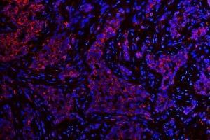IF analysis of ATG14L using anti-ATG14L antibody (ABIN3043721).