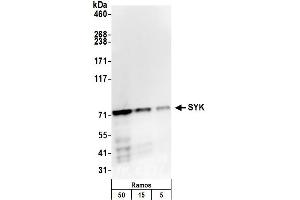 Western Blotting (WB) image for anti-Spleen tyrosine Kinase (SYK) (AA 350-400) antibody (ABIN7450791)