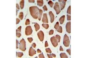 HSD11B2IHC analysis in formalin fixed and paraffin embedded skeletal muscle followed by peroxidase conjugation of the secondary antibody and DAB staining. (HSD11B2 抗体  (Middle Region))