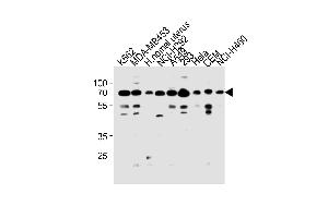 Western blot analysis in K562,MDA-MB453,NCI-H292,A549,293,Hela,CEM,NCI-H460 cell line and human nomal uterus tissue lysates (35ug/lane). (PARP3 抗体  (N-Term))