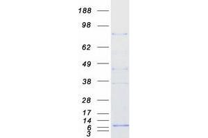 Validation with Western Blot