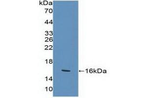 Figure. (KLRK1 抗体  (AA 92-216))