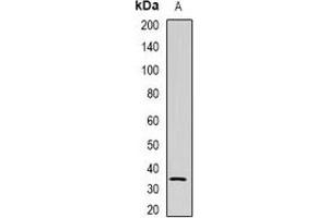 Western blot analysis of NAT1 expression in U937 (A) whole cell lysates. (NAT1 抗体)