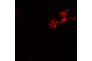 ABIN6274100 staining  HeLa cells by IF/ICC. (PHF1 抗体  (Internal Region))