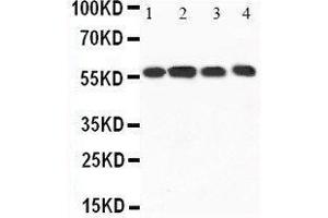 Western Blotting (WB) image for anti-Calcium/calmodulin-Dependent Protein Kinase Kinase 1, alpha (CAMKK1) (AA 10-31), (N-Term) antibody (ABIN3044431)