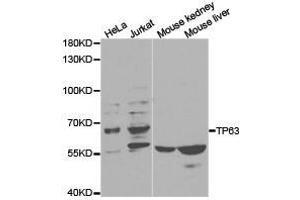 Western Blotting (WB) image for anti-Tumor Protein P63 (TP63) antibody (ABIN1875171) (p63 抗体)