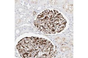 Immunohistochemical staining of human kidney with CDCP2 polyclonal antibody  shows distinct membrane positivity in renal glomeruli. (CDCP2 抗体)