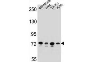 Western Blotting (WB) image for anti-Protocadherin beta 15 (PCDHB15) antibody (ABIN2996491) (PCDHB15 抗体)