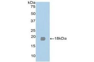 Detection of Recombinant PPARg, Human using Polyclonal Antibody to Peroxisome Proliferator Activated Receptor Gamma (PPARg) (PPARG 抗体  (AA 349-488))